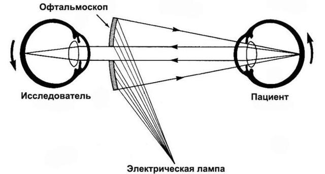 Ишемические заболевания сетчатки глаза и зрительного нерва