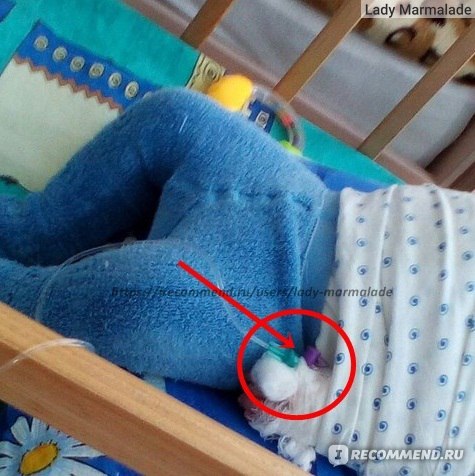 Катетер в вену - постановка. Как поставить катетер в вену