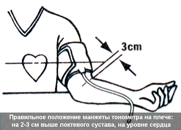 Правила измерения артериального давления