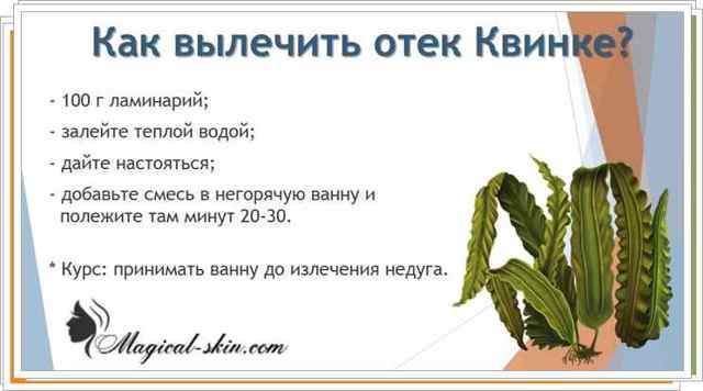 Отек Квинке симптомы и лечение в домашних условиях народными средствами
