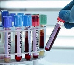 Современные методики лечения лейкоза и причины заболевания: лечится или нет, можно ли вылечить, у взрослых и детей