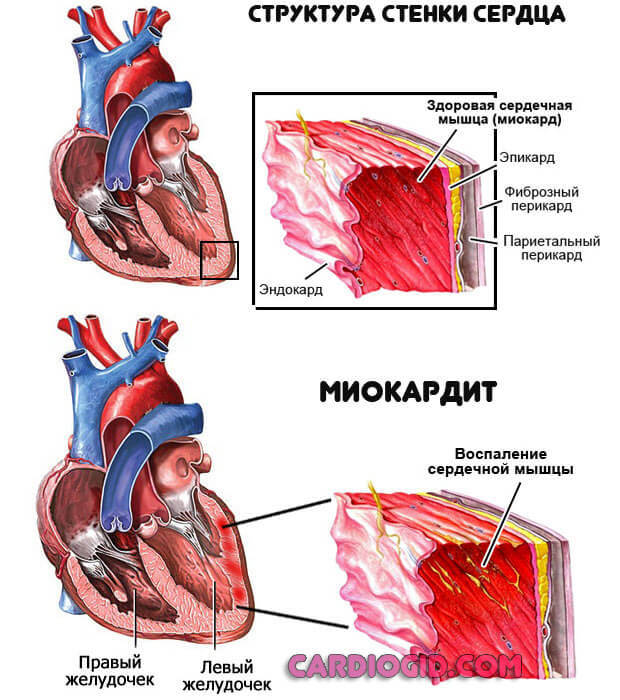 Пульс 95 в покое причины - Все про гипертонию