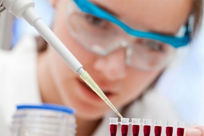 Мочевая кислота составляет уменя 755 что делать. Какая норма мочевой кислоты в крови мужчин, женщин и детей