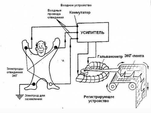 Как делают ЭКГ: техника наложения и снятия электродов, как снимают и накладывают