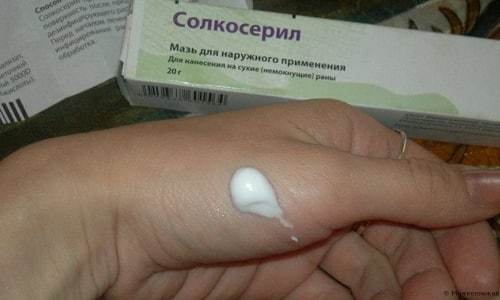 Солкосерил мазь и гель - инструкция по применению, аналоги