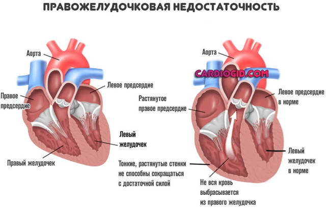УКРЕПЛЕНИЕ СЕРДЕЧНОЙ МЫШЦЫ. СЕРДЦЕ ПИТАНИЕ ПРОФИЛАКТИКА ПРОДУКТЫ СРЕДСТВА ВИТАМИНЫ