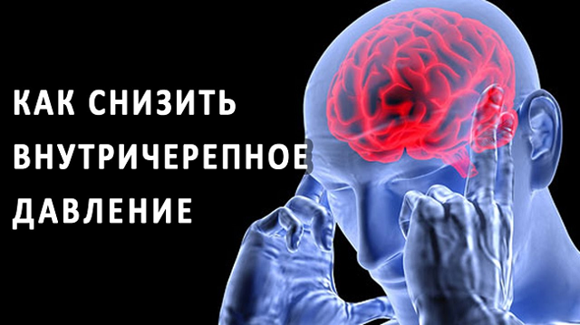 Как понизить внутричерепное давление быстро и просто?