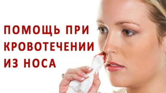 Что делать, если идет кровь из носа