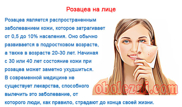 Розацеа на лице и теле: фото, симптомы, причины, лечение и видео
