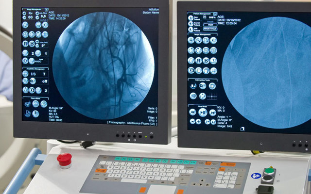 Ангиография (МРА) головного мозга. Личный опыт