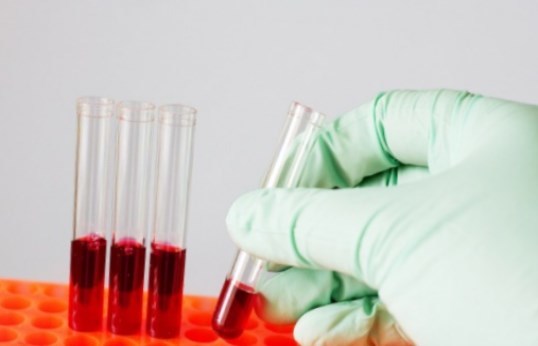 Повышенный билирубин – причины и симптомы билирубина, диагностика, лечение и профилактика