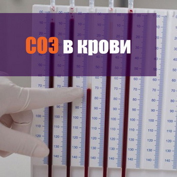 СОЭ норма для женщин после 50 - 55 лет