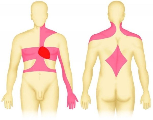 Инфаркт задней стенки сердца прогноз - Всё о сердце
