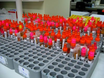 Особенности протекания и лечения миелоидного лейкоза