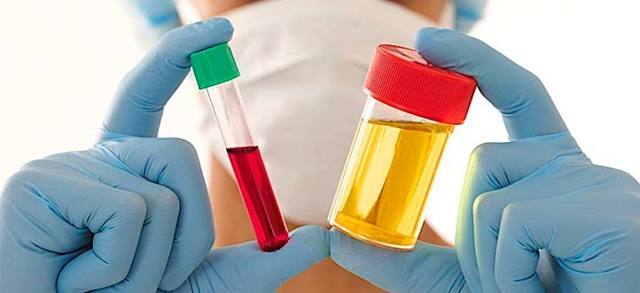 Анализ крови на ХГЧ: что это такое, когда сдавать