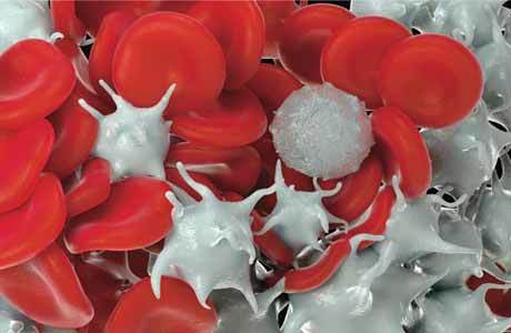 Повышены тромбоциты и повышены лимфоциты