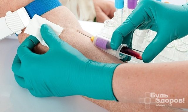 Общий анализ крови – ОАК. Нормы и расшифровка показателей общего анализа крови