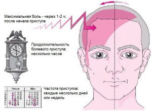 Мигрень: как снять боль. Как снять головную боль при мигрени