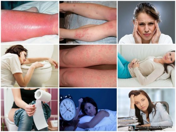 Венотоники при варикозе ног - гель, уколы, отзывы