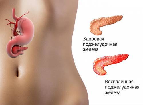 Диастаза крови норма у женщин