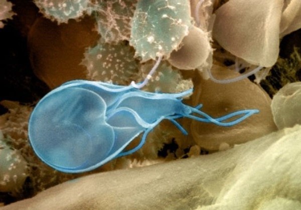 Лечение лямблиоза у взрослых медикаментозными средствами. Детальные схемы лечения и дозировка препаратов. Лямблии у взрослых: симптомы и лечение 18964 0