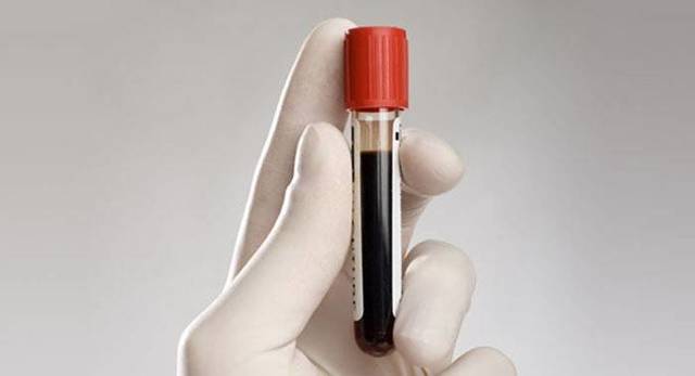 Редкая кровь какая