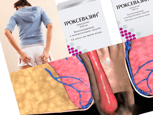 Троксевазин гель при геморрое как применять — Сайт о геморрое
