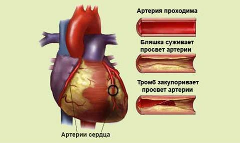 Атриовентрикулярная проводимость Википедия