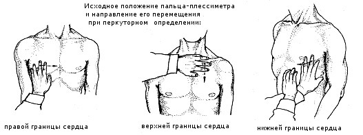 Определение границ относительной тупости сердца