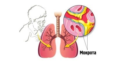 Стодаль от кашля для детей: инструкция по применению сиропа и отзывы, цены