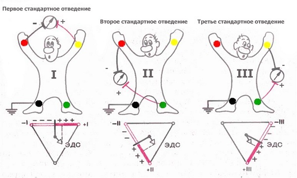 Техника снятия электрокардиограммы