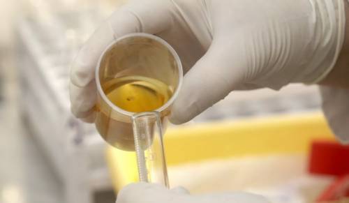 Причины кровотечения из заднего прохода. Что делать, последствия