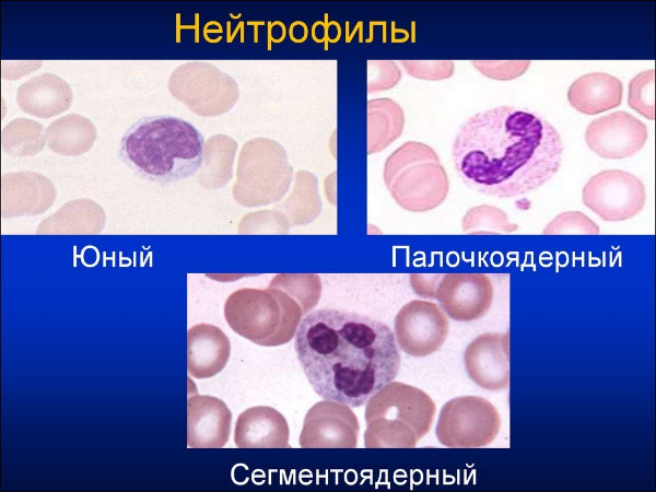 Палочкоядерные нейтрофилы: что это, норма, повышены