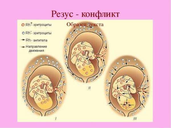 Какой резус фактор лучше – при переливании, беременности и наследовании?