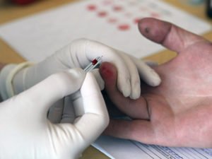 Чем прокалывают палец когда берут кровь. Зачем нужно сдавать кровь из пальца