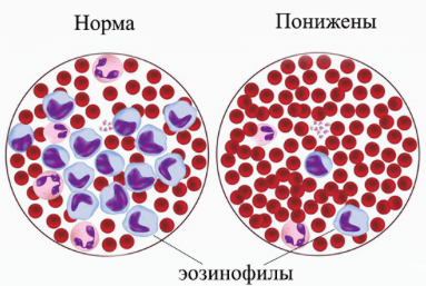 Эозинофилы понижены у ребенка - что это значит?