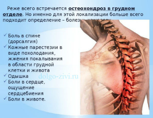 Экстрасистолия при остеохондрозе - что это такое и как лечить