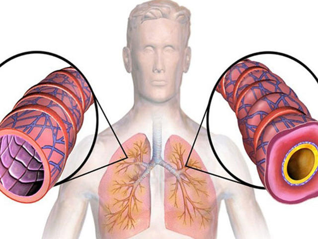 Викасол - таблетки и ампулы: цена и инструкция по применению лекарства