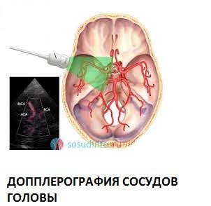Исследование сосудов головного мозга и шеи: доплерографическое, МРТ, ЭХО, ангиография