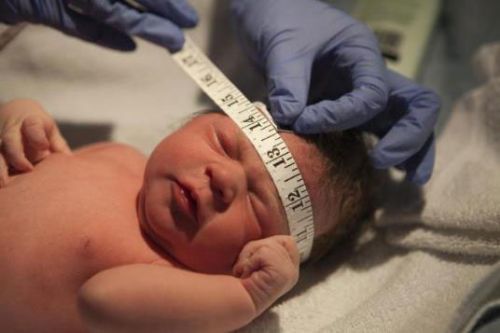 Киста сосудистого сплетения головного мозга: возникновение, диагностика, лечение. Опасна ли киста сосудистого сплетения для новорожденного?