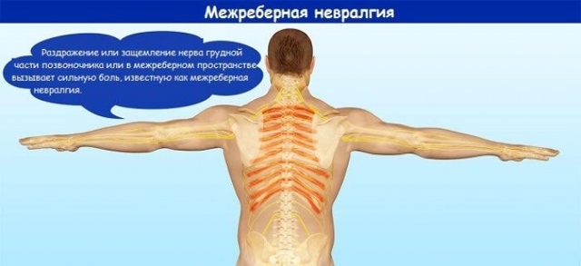 Боли под грудью: причины, диагностика и лечение