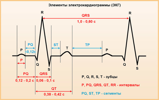 ЭКГ при инфаркте миокарда: фото пленок и расшифровка признаков