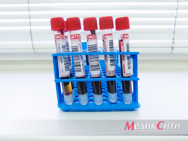 Ишемическая болезнь сердца: симптомы и лечение ишемической болезни сердца, что это такое и чем оно опасно для человека