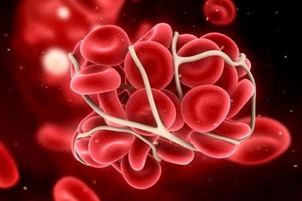 Цитрамон повышает давление или понижает: инструкция по применению