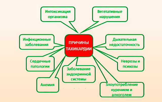 Тахикардия - что это такое. Что можно и нельзя делать при тахикардии.