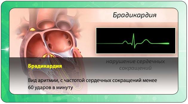Как повысить пульс в домашних условиях