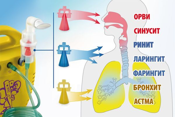 Лазолван инструкция по применению для ингаляций: раствор и капли