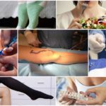 Послеоперационный период при операции на венах ног