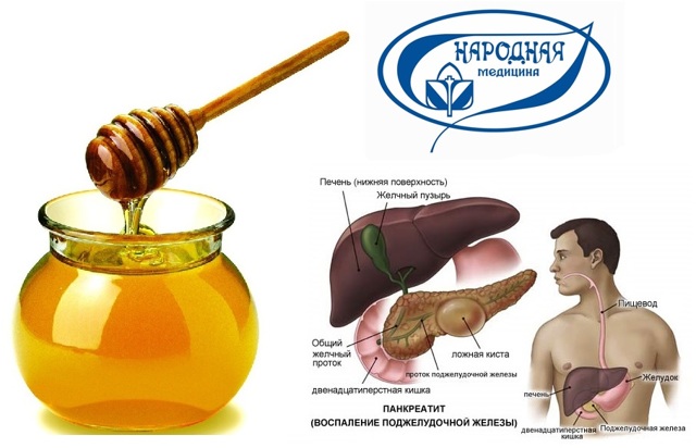 Можно ли есть мед при панкреатите поджелудочной железы или нет, лечение
