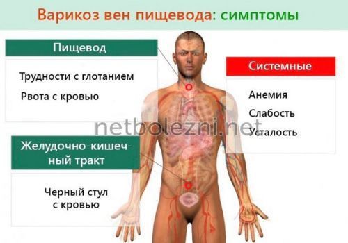 Кал черного цвета у взрослого - возможные причины